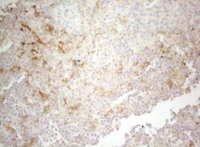 Immunohistochemistry: PTK9 Antibody (OTI5C12) - Azide and BSA Free [NBP2-73710]