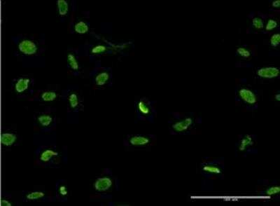 Immunocytochemistry/ Immunofluorescence: PTMS Antibody (3H5) [H00005763-M17-100ug]