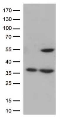Western Blot: PTOP Antibody (OTI2D5)Azide and BSA Free [NBP2-73711]