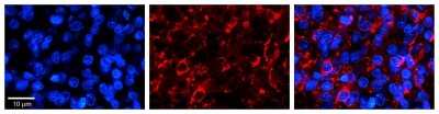Immunohistochemistry: PTOV1 Antibody [NBP1-79384]