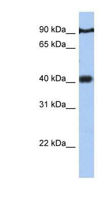 Western Blot: PTOV1 Antibody [NBP1-79384]