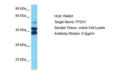 Western Blot: PTOV1 Antibody [NBP1-79384]
