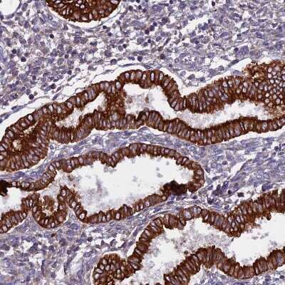 Immunohistochemistry-Paraffin: PTP-MEG2/PTPN9 Antibody [NBP1-81243]
