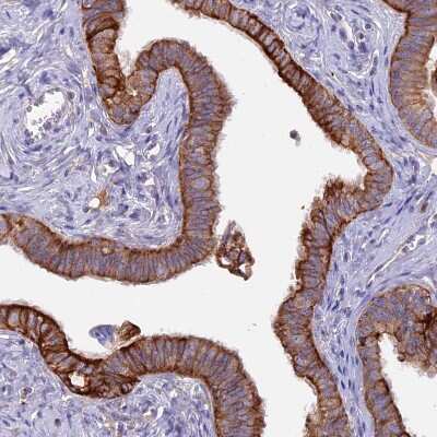 Immunohistochemistry-Paraffin: PTP-MEG2/PTPN9 Antibody [NBP1-81243]