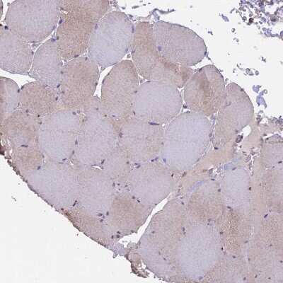 Immunohistochemistry-Paraffin: PTP-MEG2/PTPN9 Antibody [NBP1-81243]