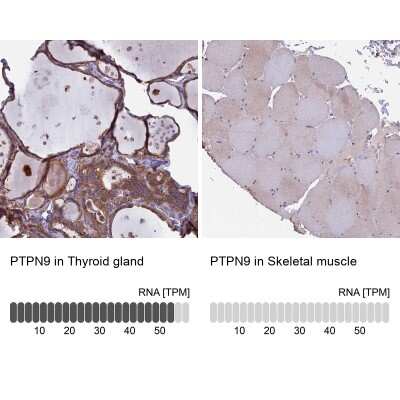 Immunohistochemistry-Paraffin: PTP-MEG2/PTPN9 Antibody [NBP1-81243]