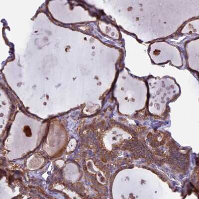 Immunohistochemistry-Paraffin: PTP-MEG2/PTPN9 Antibody [NBP1-81243]