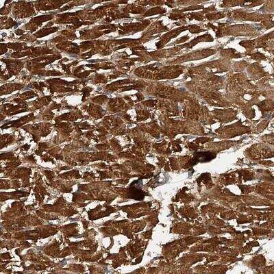 Immunohistochemistry: PTP alpha/PTPRA Antibody [NBP1-89683]