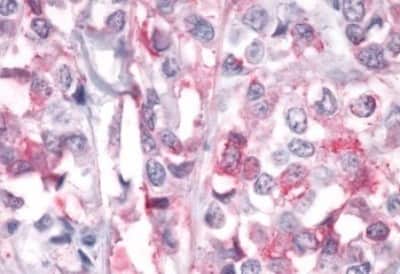 Immunohistochemistry: PTP alpha/PTPRA Antibody [NBP3-14454]