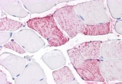 Immunohistochemistry-Paraffin: PTP alpha/PTPRA Antibody [NBP3-14454]