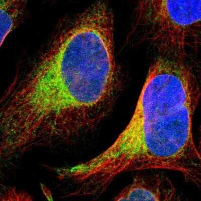 Immunocytochemistry/ Immunofluorescence: PTP1B/PTPN1 Antibody [NBP1-87191]