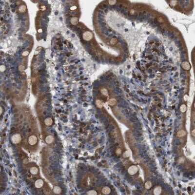 Immunohistochemistry-Paraffin: PTP1B/PTPN1 Antibody [NBP1-87191]