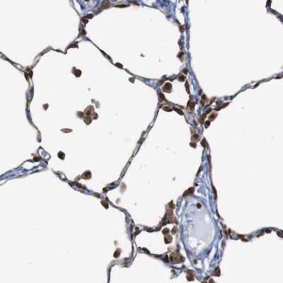 Immunohistochemistry-Paraffin: PTP1B/PTPN1 Antibody [NBP1-87191]