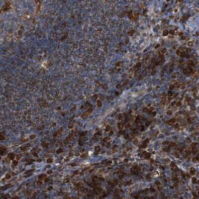 Immunohistochemistry-Paraffin: PTP1B/PTPN1 Antibody [NBP1-87191]
