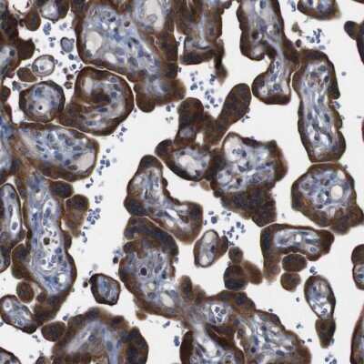 Immunohistochemistry-Paraffin: PTP1B/PTPN1 Antibody [NBP1-87191]