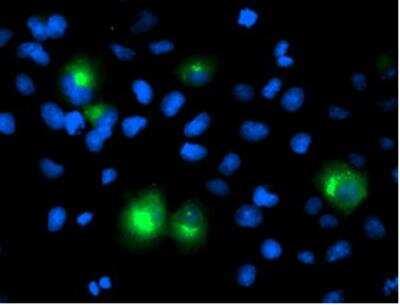 Immunocytochemistry/ Immunofluorescence: PTP1B/PTPN1 Antibody (OTI1D10) - Azide and BSA Free [NBP2-73729]