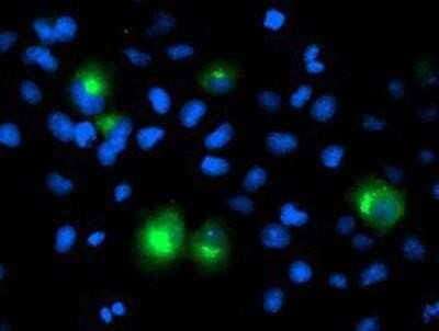 Immunocytochemistry/ Immunofluorescence: PTP1B/PTPN1 Antibody (OTI1D10) [NBP2-01056]
