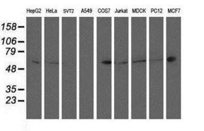 Western Blot: PTP1B/PTPN1 Antibody (OTI1D10) [NBP2-01056]