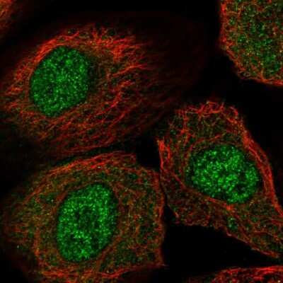 Immunocytochemistry/ Immunofluorescence: PTPDC1 Antibody [NBP1-81949]
