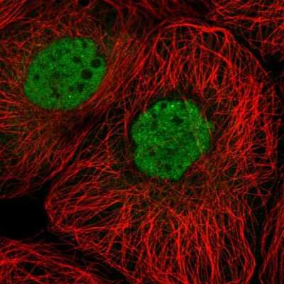 Immunocytochemistry/ Immunofluorescence: PTPDC1 Antibody [NBP1-81950]