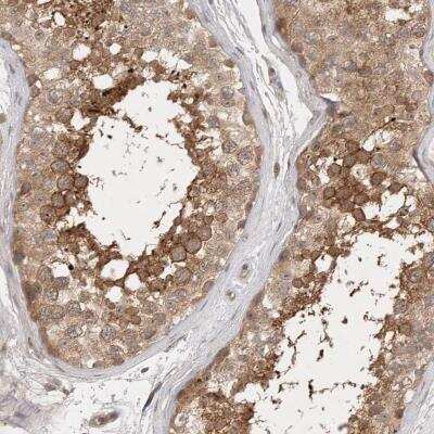 Immunohistochemistry-Paraffin: PTPDC1 Antibody [NBP1-81949]