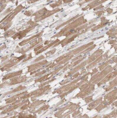 Immunohistochemistry-Paraffin: PTPDC1 Antibody [NBP1-81949]