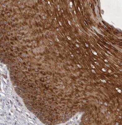 Immunohistochemistry-Paraffin: PTPDC1 Antibody [NBP1-81949]