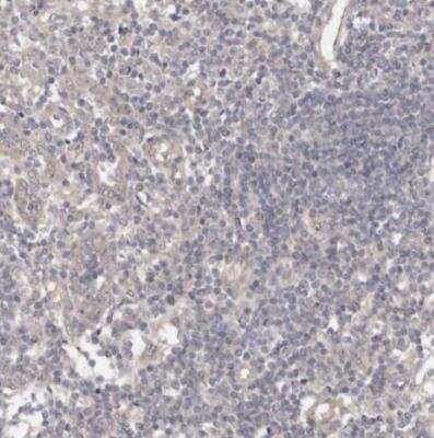 Immunohistochemistry-Paraffin: PTPDC1 Antibody [NBP1-81949]