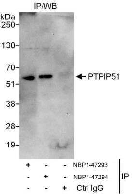 Immunoprecipitation: PTPIP51 Antibody [NBP1-47293]