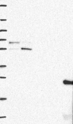 Western Blot: PTPIP51 Antibody [NBP3-17917]
