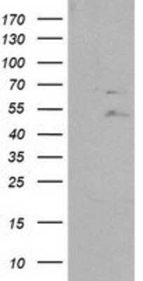 Western Blot: SHP-2/PTPN11 Antibody (OTI3F2) [NBP2-03063]