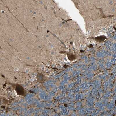 Immunohistochemistry-Paraffin: PTPN12 Antibody [NBP1-87188]
