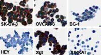 Immunohistochemistry-Paraffin: PTPN13/PTPL1 Antibody [NB100-56139]