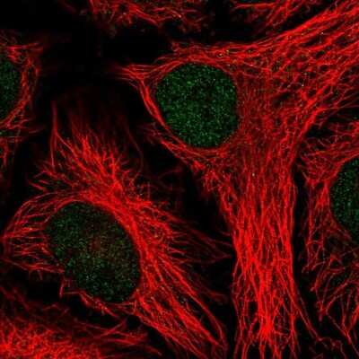 Immunocytochemistry/ Immunofluorescence: PTPN14/PTPD2 Antibody [NBP2-38712]