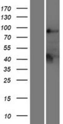 Western Blot: Lyp/PTPN22 Overexpression Lysate [NBL1-14973]