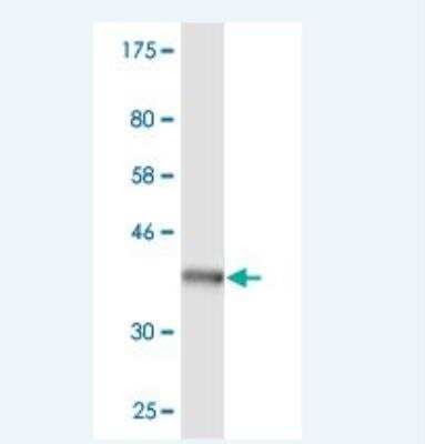 Western Blot: PTPN4 Antibody (2C8) [H00005775-M06]