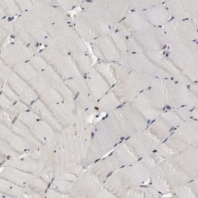 Immunohistochemistry-Paraffin: SHP-1 Antibody [NBP1-83276]