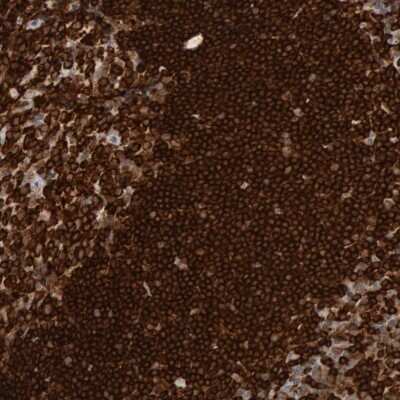 Immunohistochemistry-Paraffin: SHP-1 Antibody [NBP1-83276]
