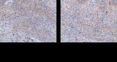 Immunohistochemistry-Paraffin: PTPN7 Antibody [NBP1-81756]
