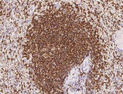 Immunohistochemistry-Paraffin: PTPRCAP Antibody [NBP3-12620]