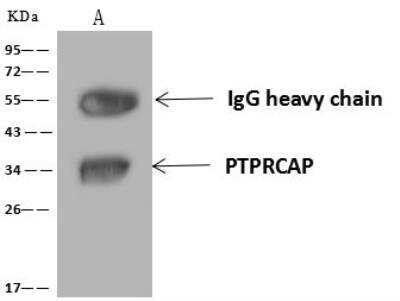 Immunoprecipitation: PTPRCAP Antibody [NBP3-12620]