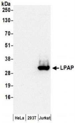 Western Blot: PTPRCAP Antibody [NBP2-36565]