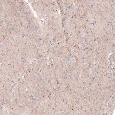 Immunohistochemistry-Paraffin: PTPRK Antibody [NBP2-30977]