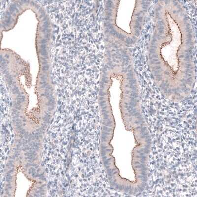 Immunohistochemistry-Paraffin: PTPRK Antibody [NBP2-30977]