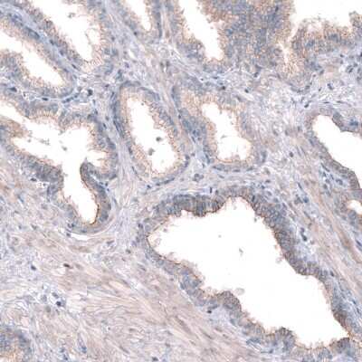 Immunohistochemistry-Paraffin: PTPRK Antibody [NBP2-30977]