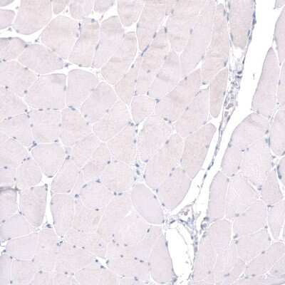 Immunohistochemistry-Paraffin: PTPRK Antibody [NBP2-30977]