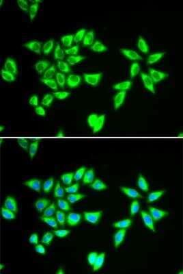 Immunocytochemistry/ Immunofluorescence: PTRH2 Antibody - BSA Free [NBP2-94026]