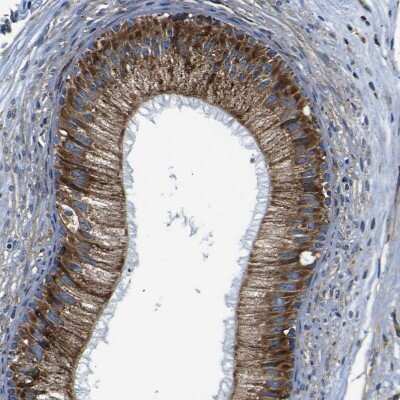 Immunohistochemistry-Paraffin: PTRH2 Antibody [NBP1-88595]