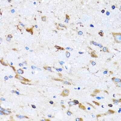 Immunohistochemistry-Paraffin: PTRH2 Antibody - BSA Free [NBP2-94026]