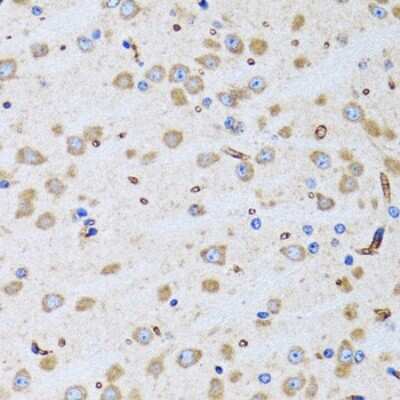 Immunohistochemistry-Paraffin: PTRH2 Antibody - BSA Free [NBP2-94026]
